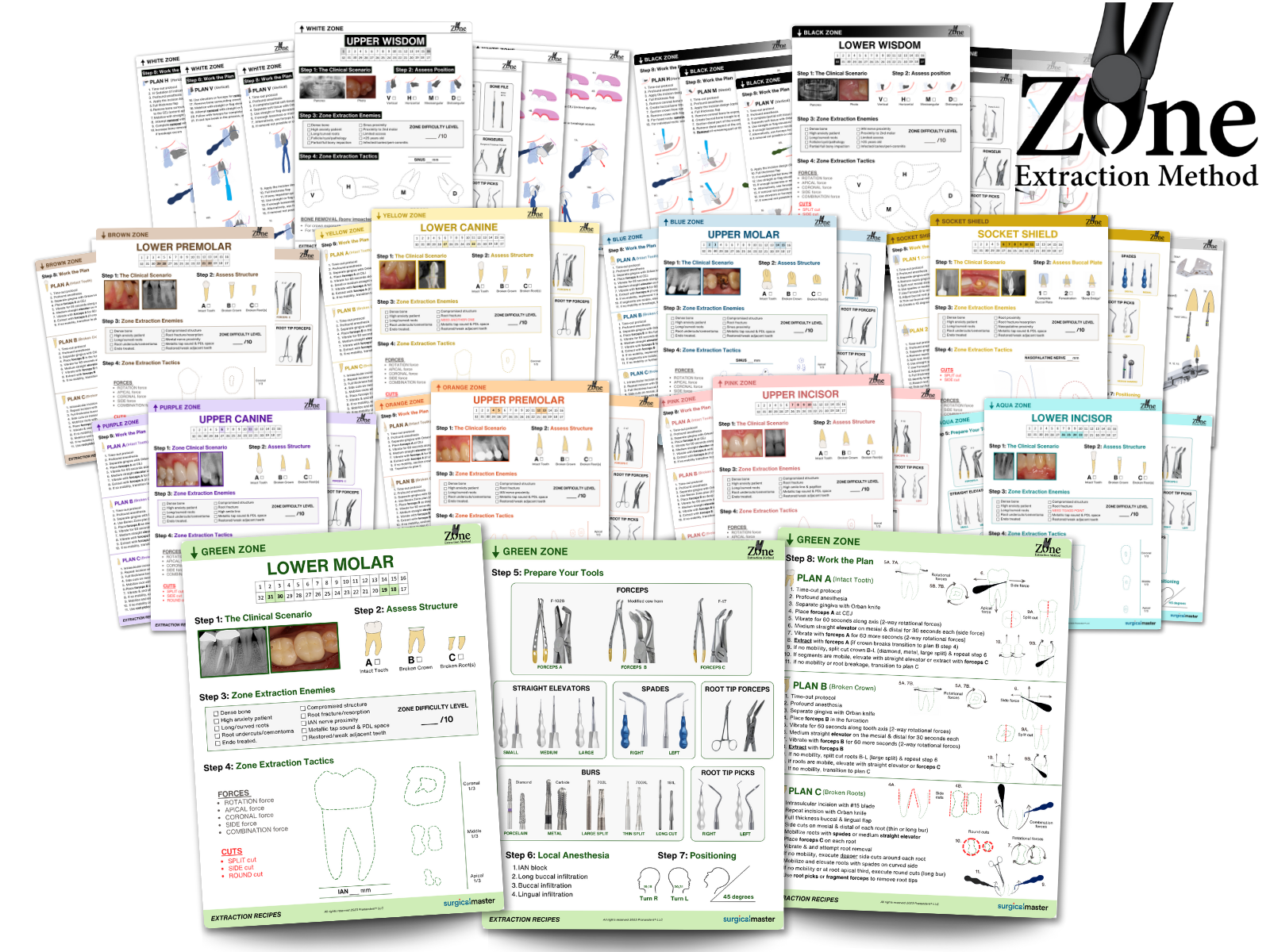 The Zone Extraction Method | Surgical Master